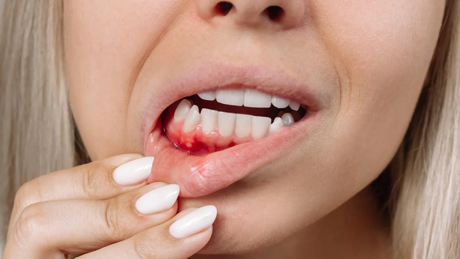 Patient in dental chair during teeth extraction consultation