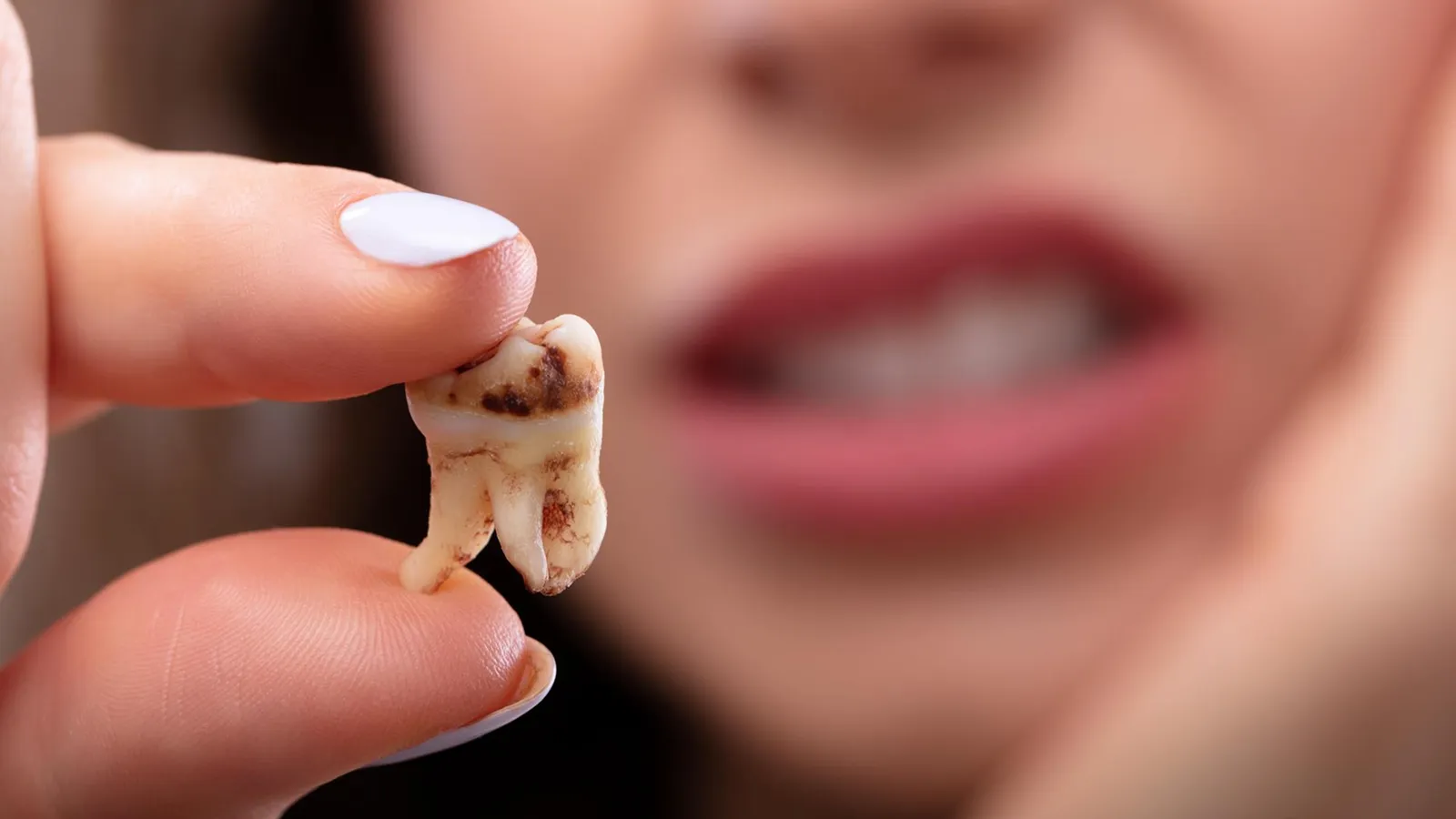 Patient in dental chair during teeth extraction consultation