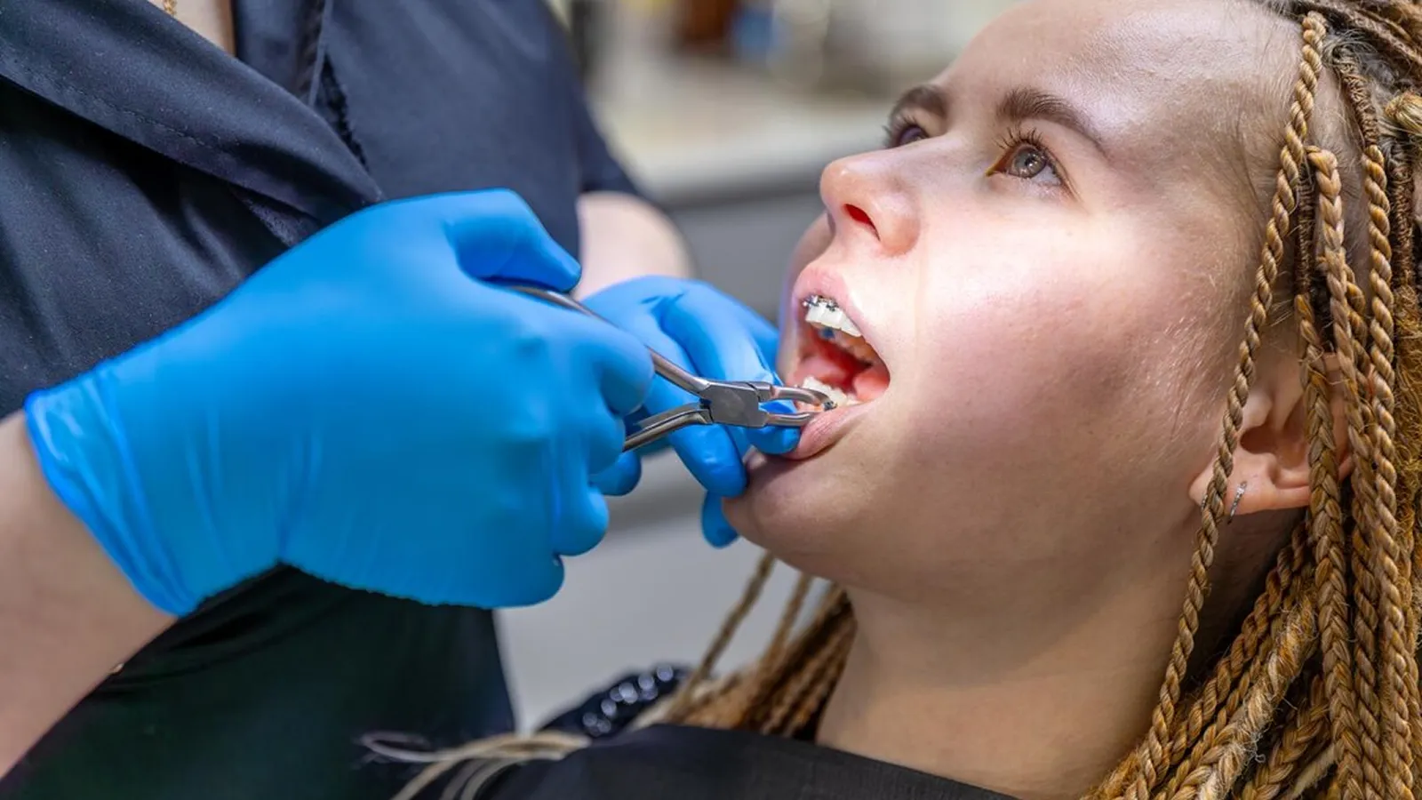 Patient in dental chair during teeth extraction consultation