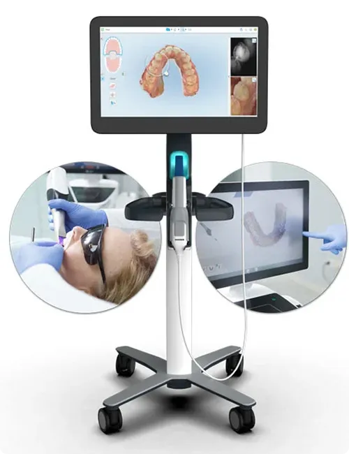 iTero intraoral scanner