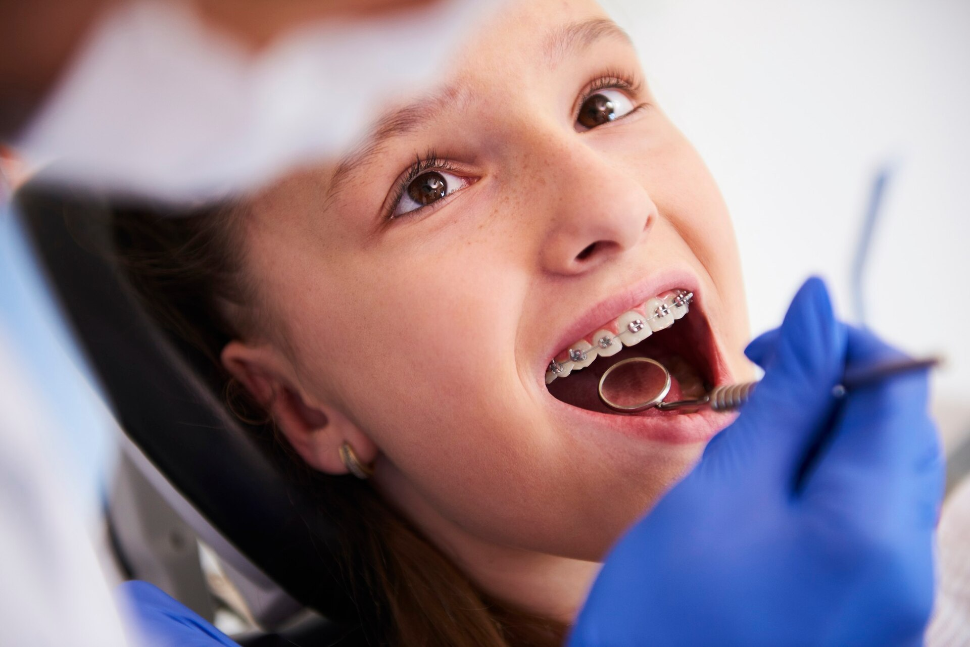 Why Braces Treatment Matters
